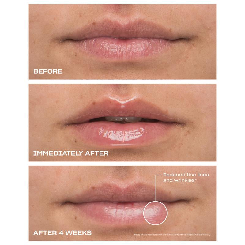 Cloud 9 Lip Serum: Daily Peptide Treatment for Smoother, Hydrated, and Firmer Lips - Lightweight Lip Care Solution